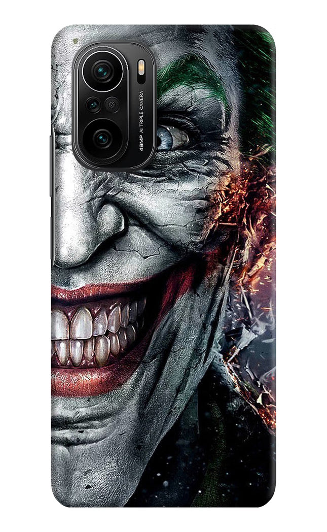 Joker Cam Mi 11X/11X Pro Hard Case Back Cover by Casekaro