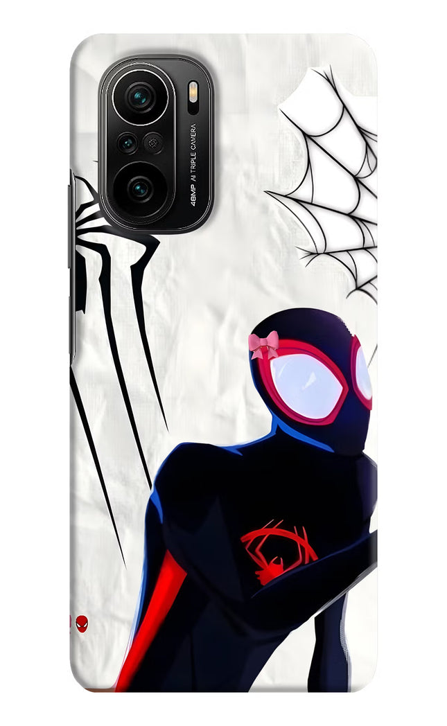 Miles Verse Mi 11X/11X Pro Hard Case Back Cover by Casekaro