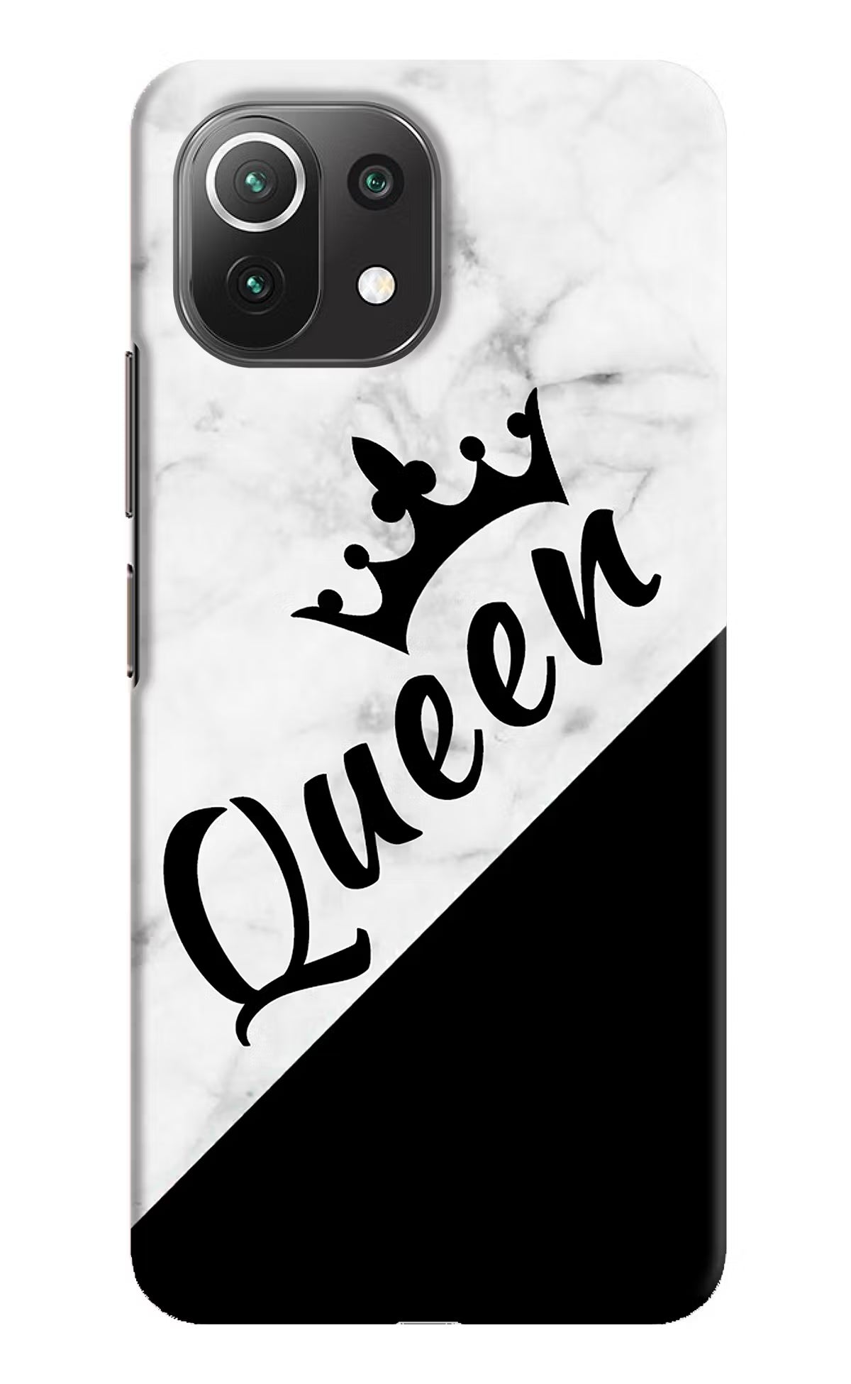 Queen Mi 11 Lite Hard Case Back Cover by Casekaro