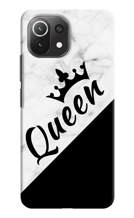 Queen Mi 11 Lite Hard Case Back Cover by Casekaro