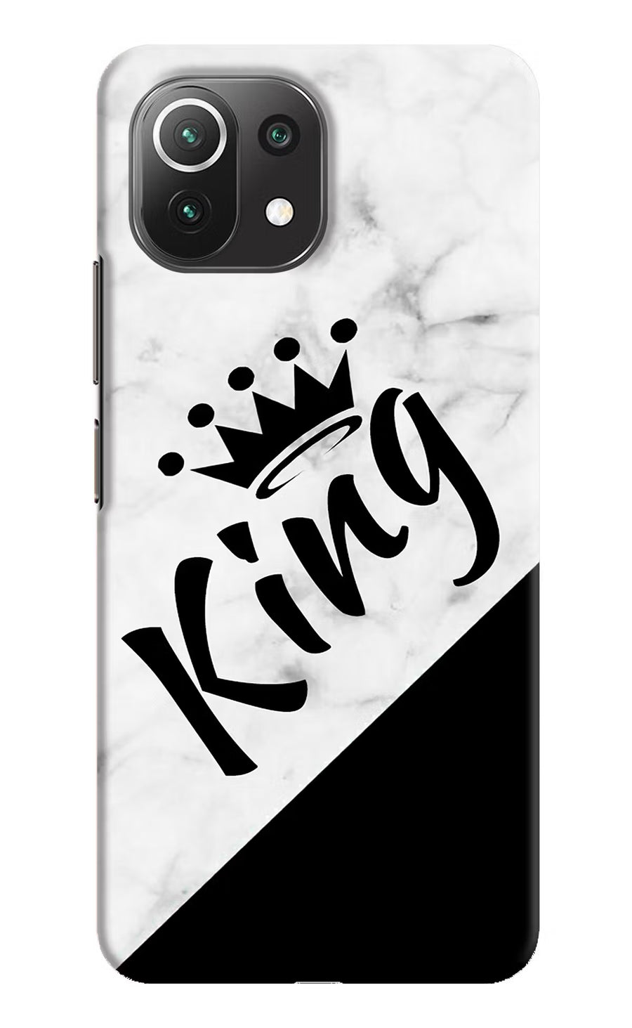 King Mi 11 Lite Back Cover, Hard case