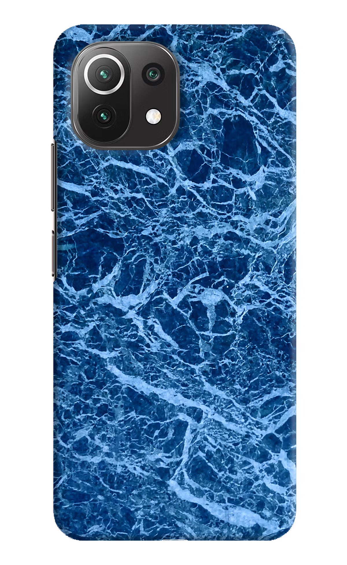 Blue Marble Mi 11 Lite Hard Case Back Cover by Casekaro