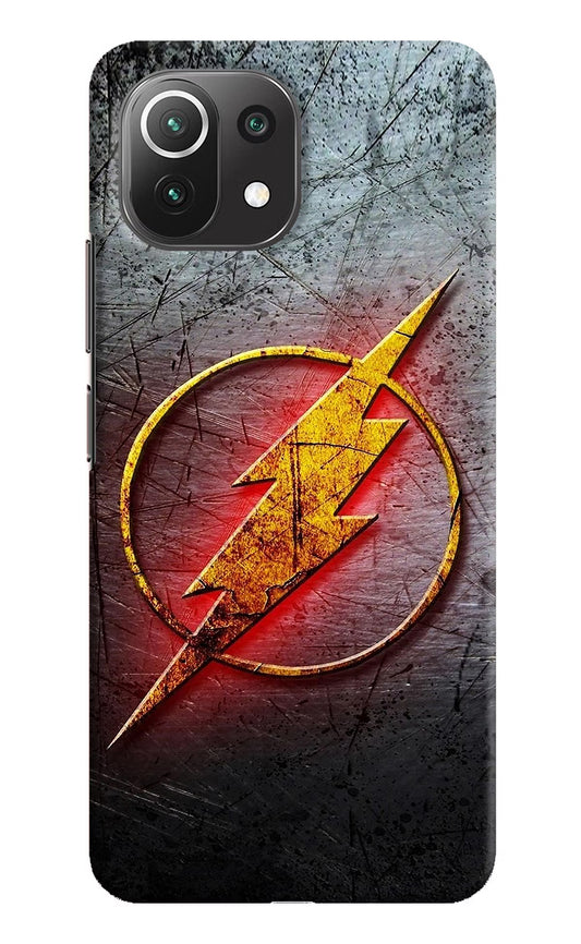 Flash Mi 11 Lite Hard Case Back Cover by Casekaro