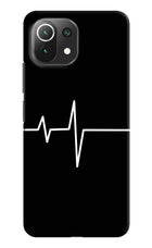 Heart Beats Mi 11 Lite Hard Case Back Cover by Casekaro