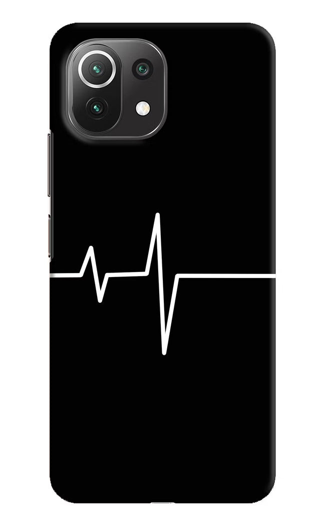Heart Beats Mi 11 Lite Hard Case Back Cover by Casekaro
