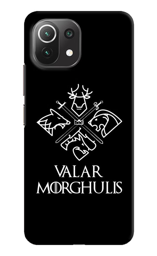 Valar Morghulis | Game Of Thrones Mi 11 Lite Hard Case Back Cover by Casekaro