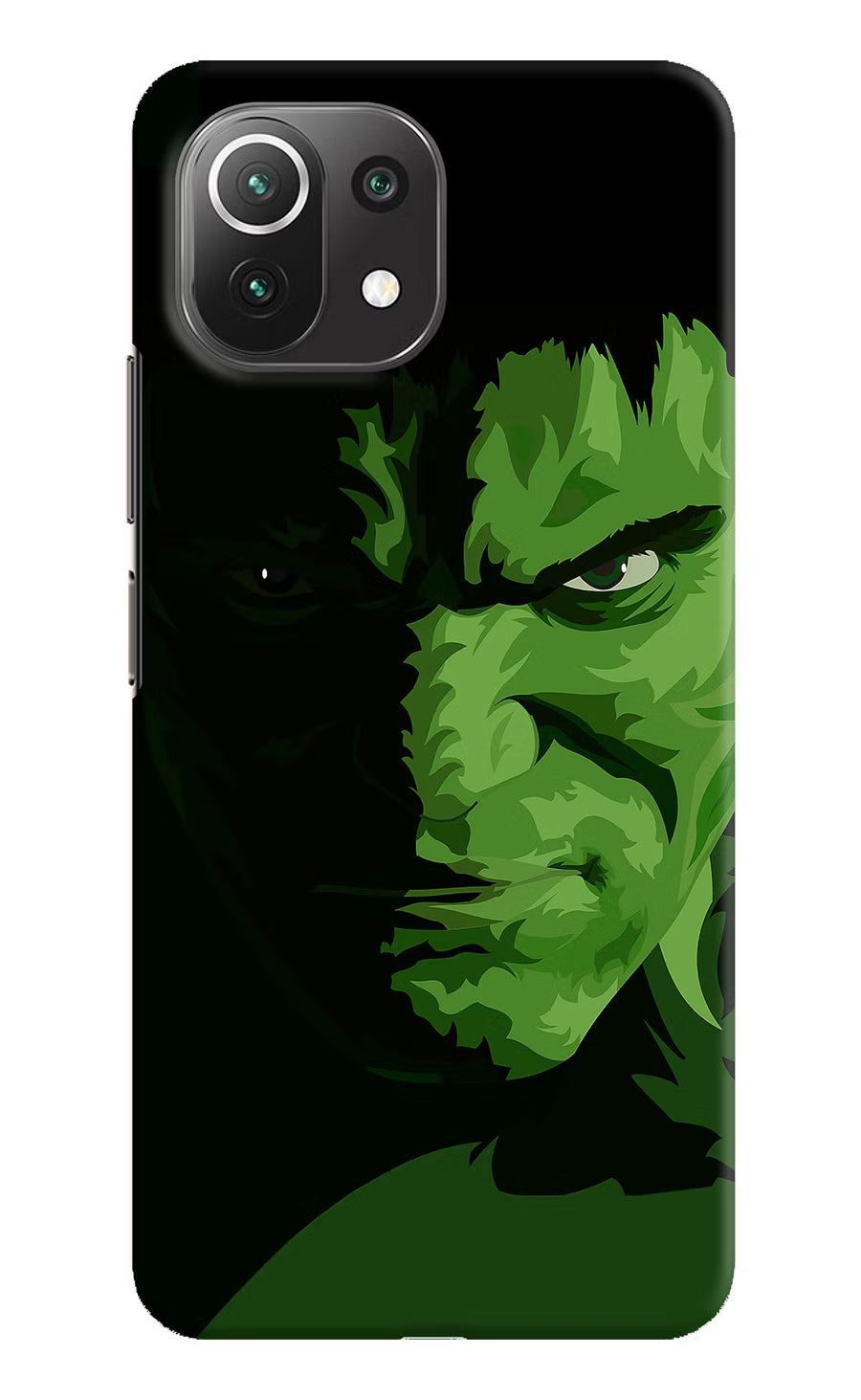 HULK Mi 11 Lite Back Cover, Hard case