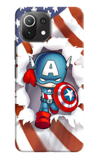 Captain America Mi 11 Lite Hard Case Back Cover by Casekaro