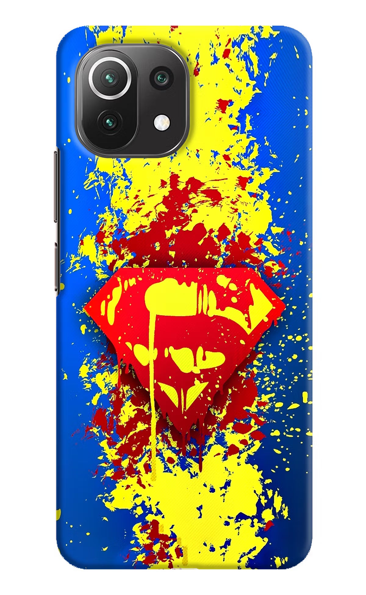 Superman logo Mi 11 Lite Hard Case Back Cover by Casekaro