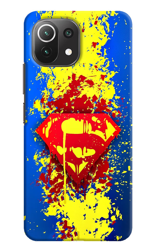 Superman logo Mi 11 Lite Hard Case Back Cover by Casekaro