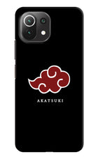 Akatsuki Mi 11 Lite Hard Case Back Cover by Casekaro