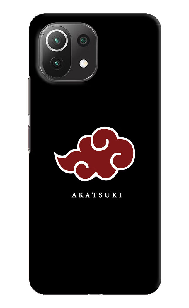 Akatsuki Mi 11 Lite Hard Case Back Cover by Casekaro