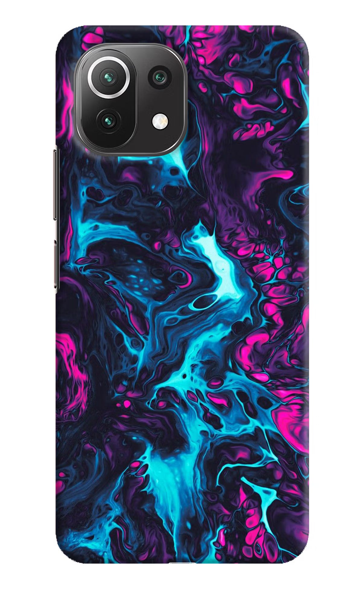 Abstract Mi 11 Lite Hard Case Back Cover by Casekaro