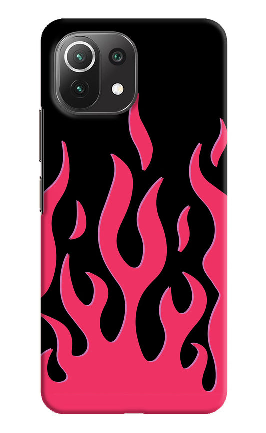 Fire Flames Mi 11 Lite Hard Case Back Cover by Casekaro