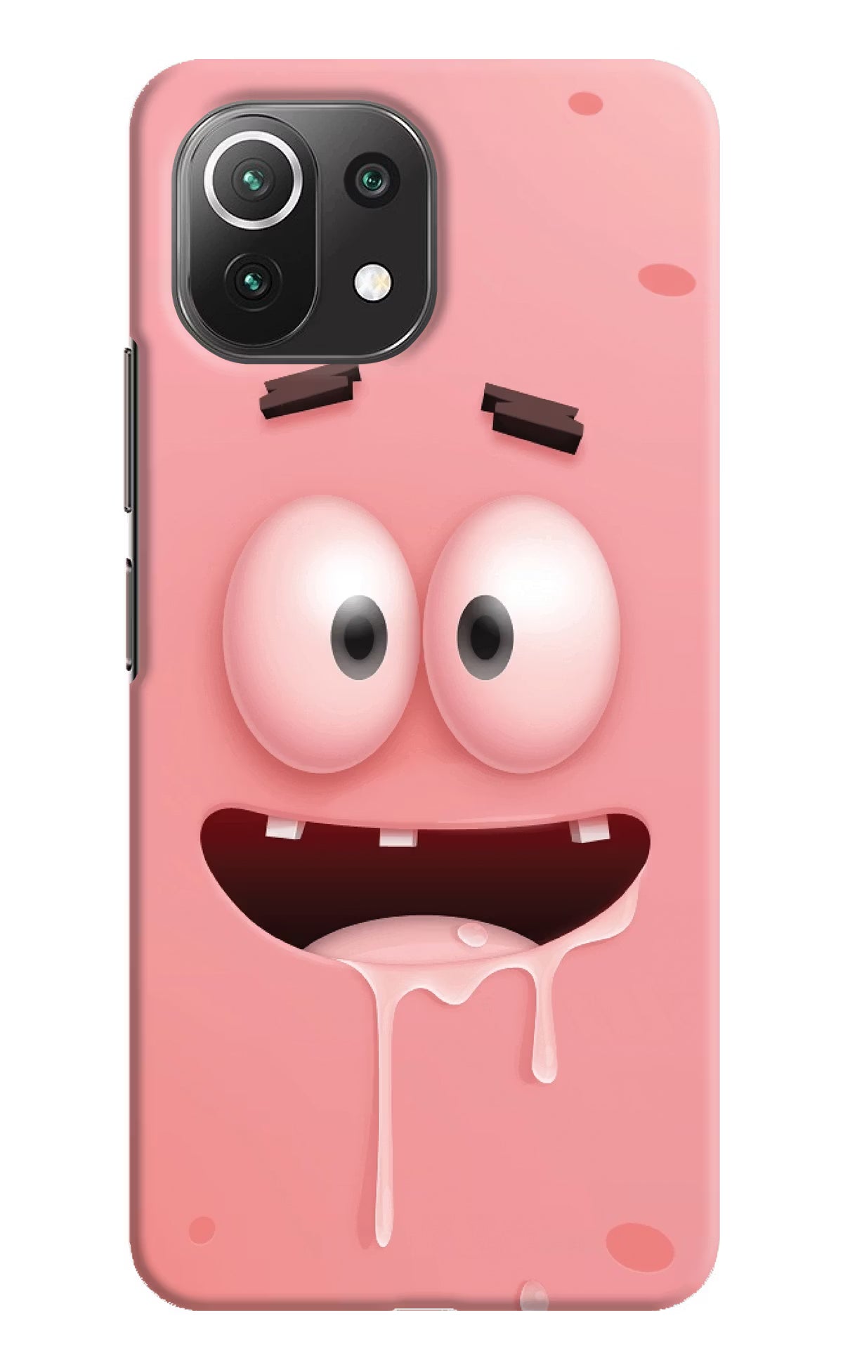 Sponge 2 Mi 11 Lite Hard Case Back Cover by Casekaro