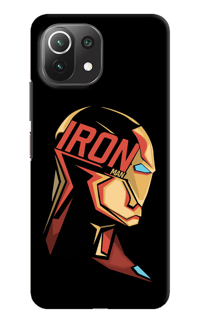 IronMan Mi 11 Lite Hard Case Back Cover by Casekaro