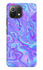 Glitter Mi 11 Lite Hard Case Back Cover by Casekaro