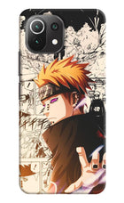Pain Anime Mi 11 Lite Hard Case Back Cover by Casekaro