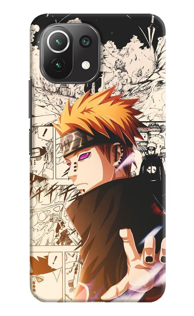 Pain Anime Mi 11 Lite Hard Case Back Cover by Casekaro