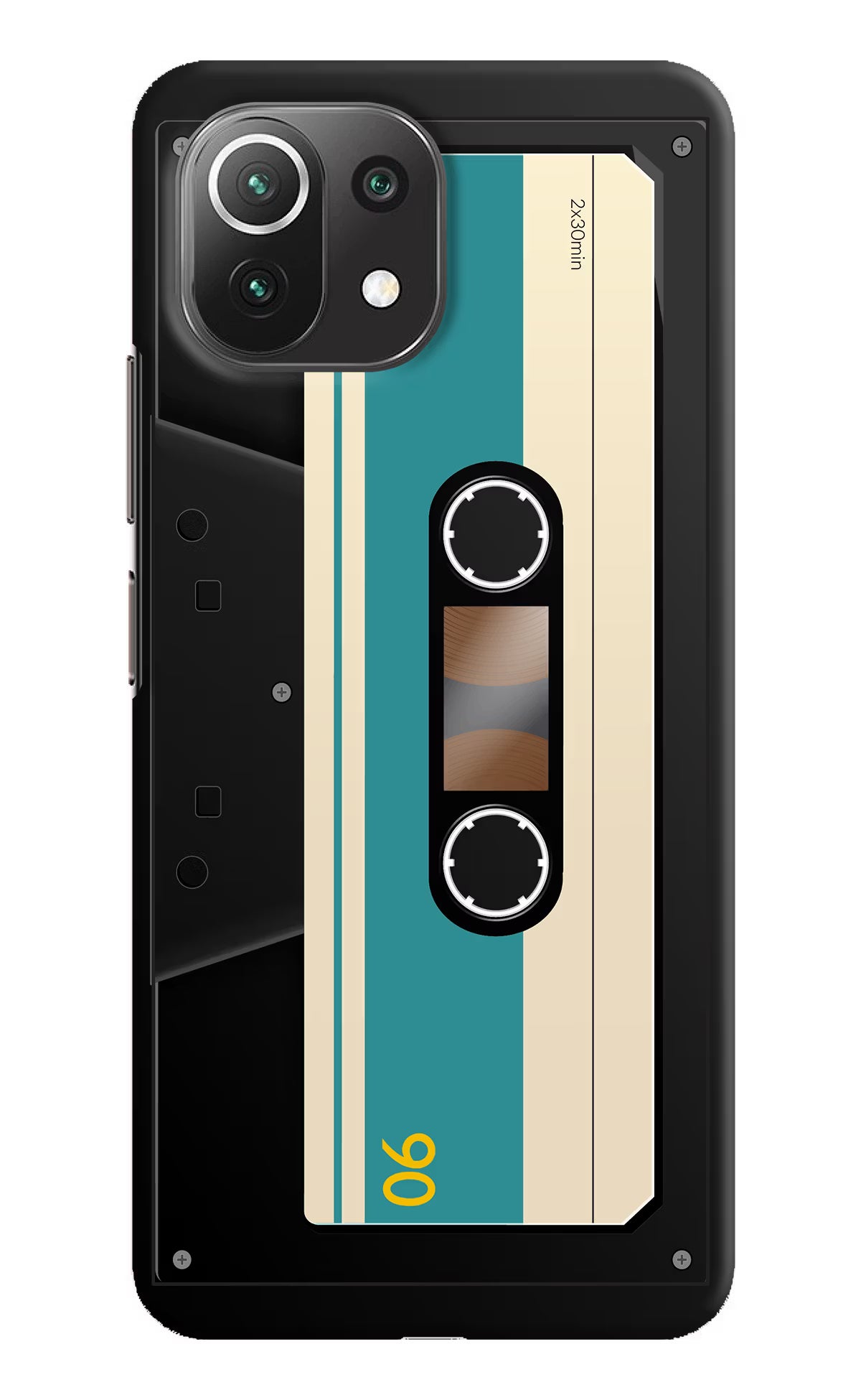 Cassette Mi 11 Lite Hard Case Back Cover by Casekaro