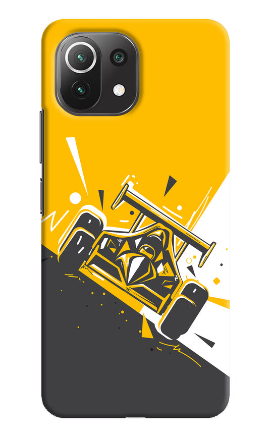 Track King Mi 11 Lite Hard Case Back Cover by Casekaro