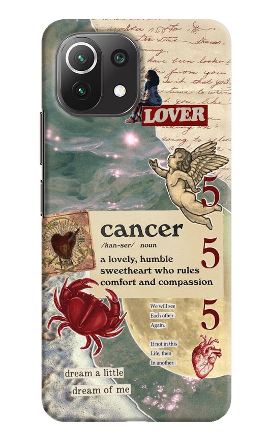 Cancer Zodiac Mi 11 Lite Hard Case Back Cover by Casekaro