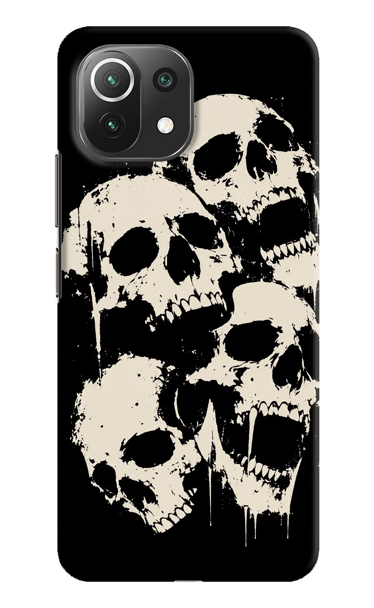 Dead Stack Mi 11 Lite Hard Case Back Cover by Casekaro