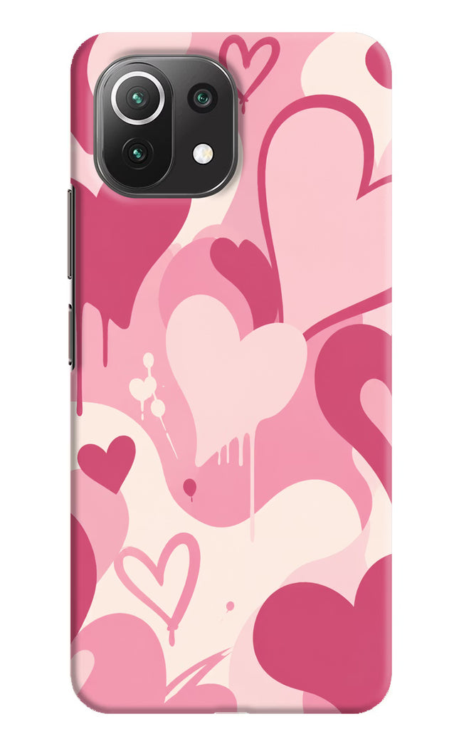 Hearty case Mi 11 Lite Hard Case Back Cover by Casekaro
