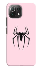 Peter Symbol Mi 11 Lite Hard Case Back Cover by Casekaro