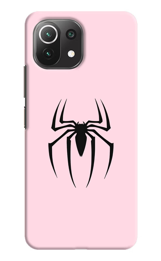 Peter Symbol Mi 11 Lite Hard Case Back Cover by Casekaro