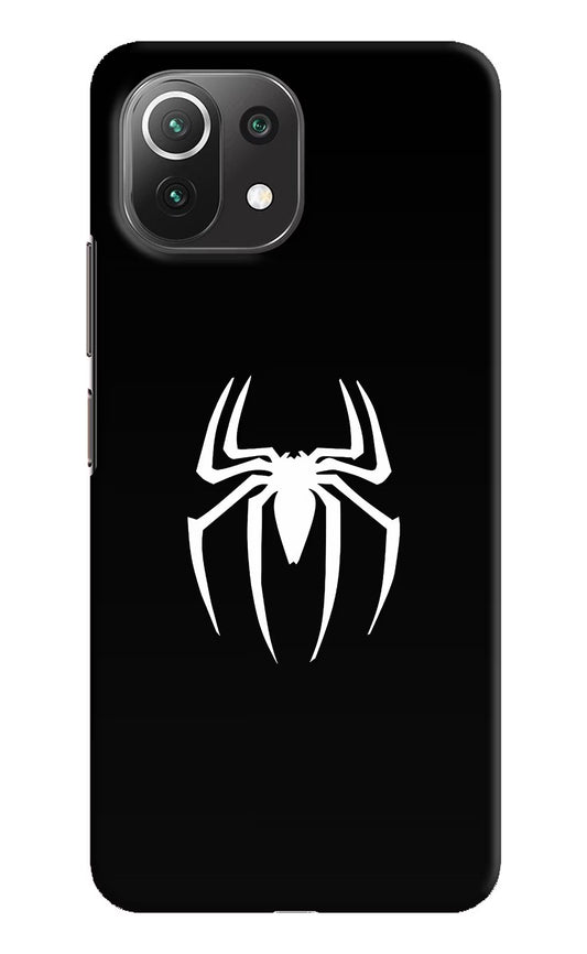 Miles Symbol Mi 11 Lite Hard Case Back Cover by Casekaro