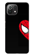 Peter Mask Mi 11 Lite Hard Case Back Cover by Casekaro