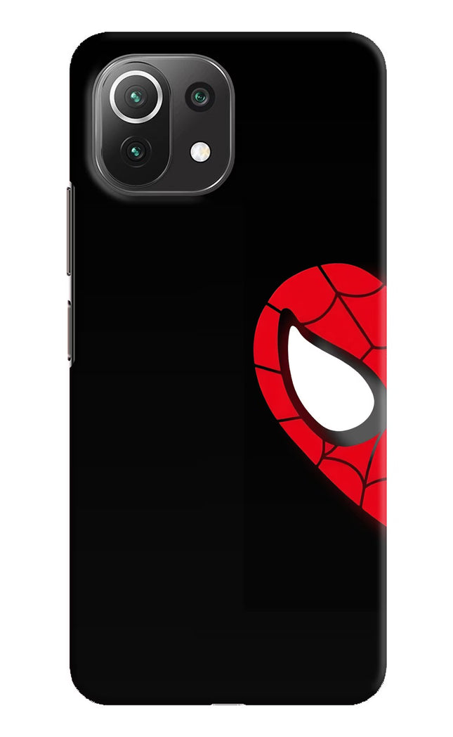 Peter Mask Mi 11 Lite Hard Case Back Cover by Casekaro