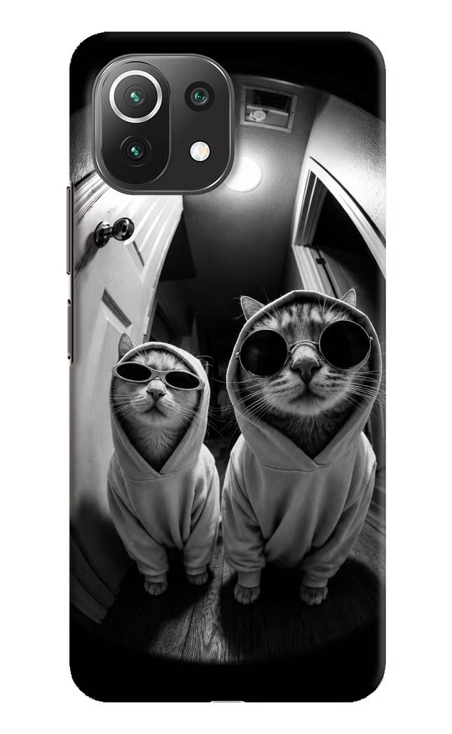 Hood Cats Mi 11 Lite Hard Case Back Cover by Casekaro