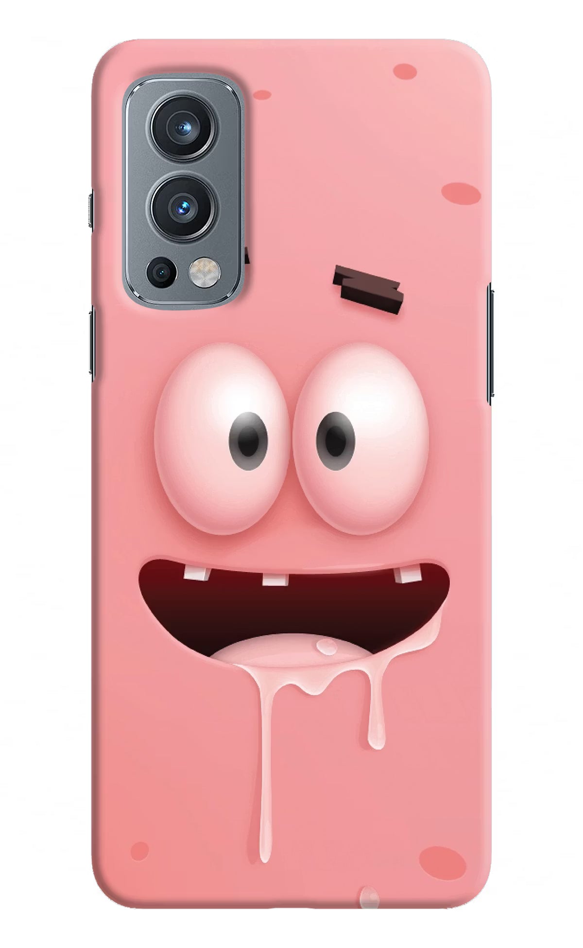Sponge 2 OnePlus Nord 2 5G Hard Case Back Cover by Casekaro