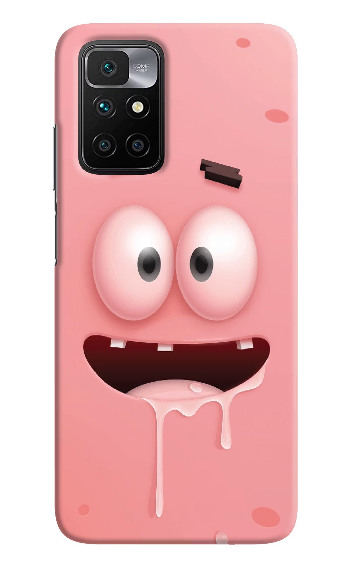 Sponge 2 Redmi 10 Prime Hard Case Back Cover by Casekaro