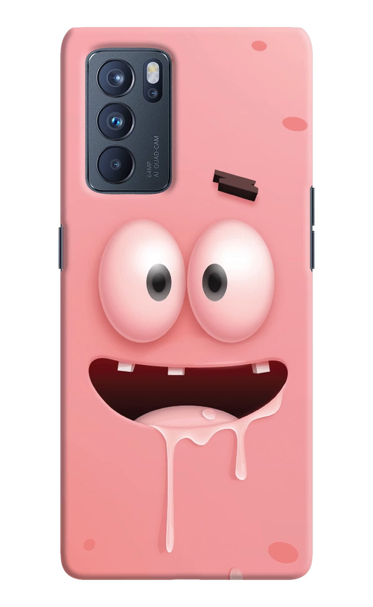 Sponge 2 Oppo Reno6 Pro 5G Hard Case Back Cover by Casekaro