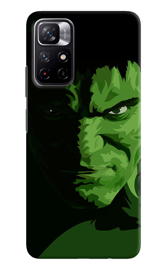 HULK Redmi Note 11T 5G Hard Case Back Cover by Casekaro