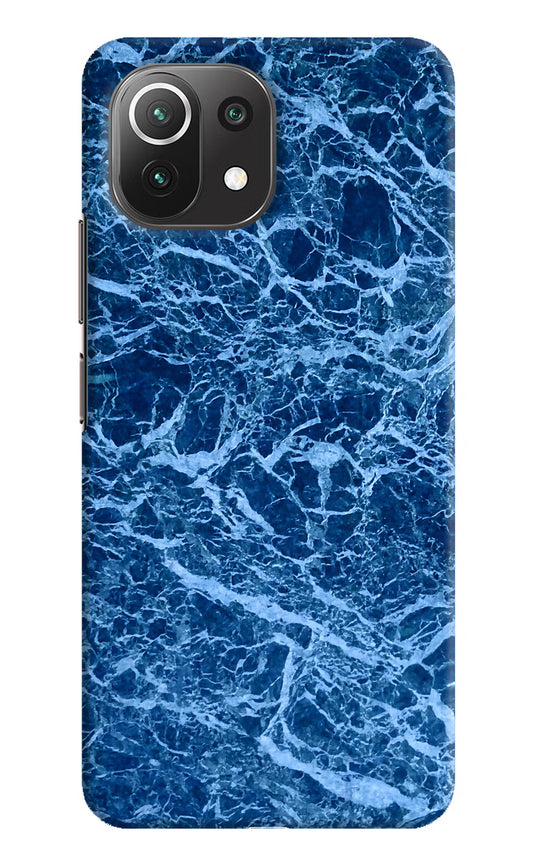 Blue Marble Mi 11 Lite NE 5G Hard Case Back Cover by Casekaro