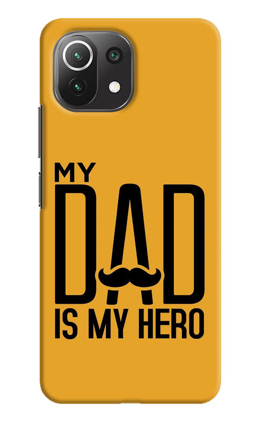 My Dad Is My Hero Mi 11 Lite NE 5G Hard Case Back Cover by Casekaro