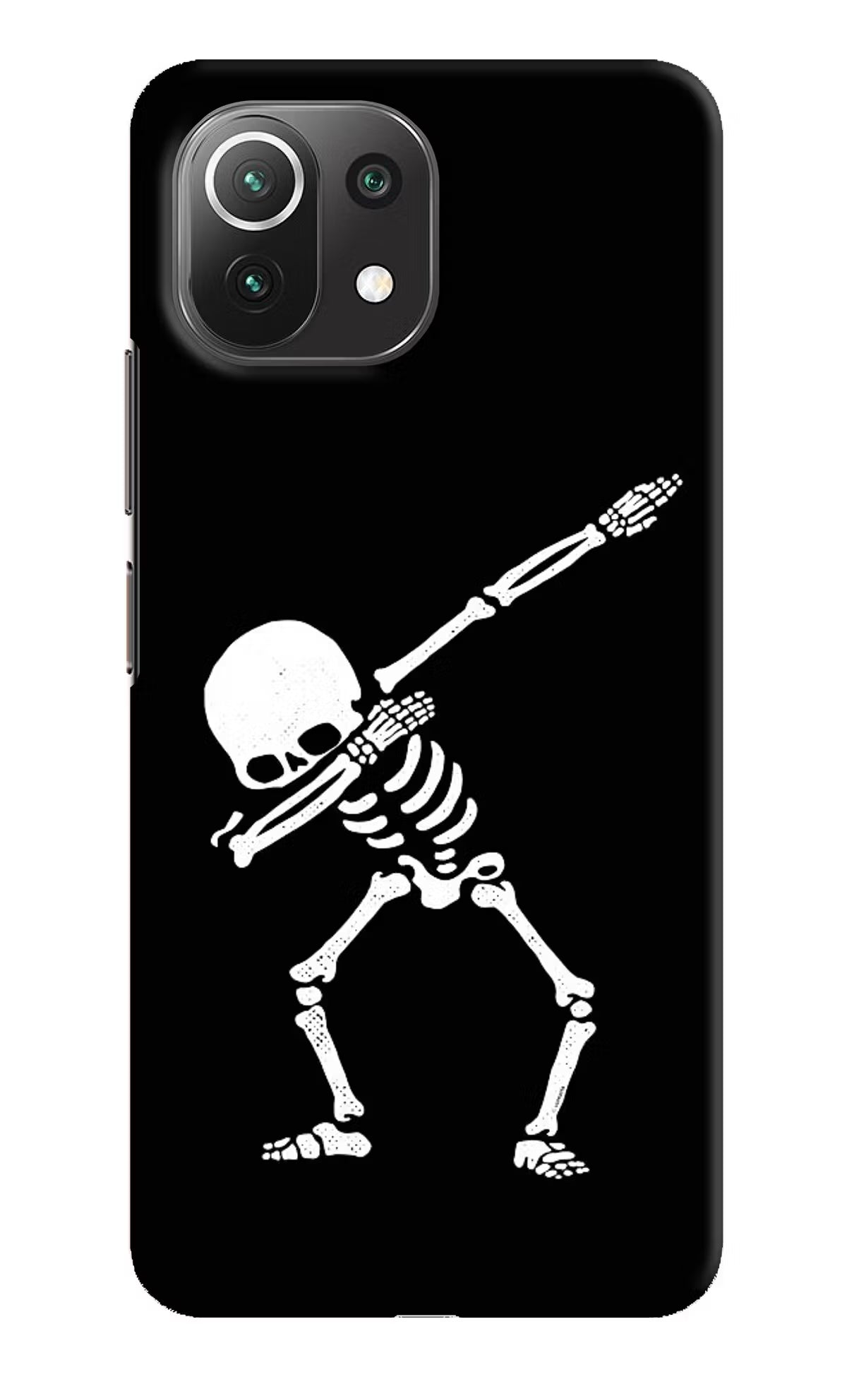 Dabbing Skeleton Art Mi 11 Lite NE 5G Hard Case Back Cover by Casekaro