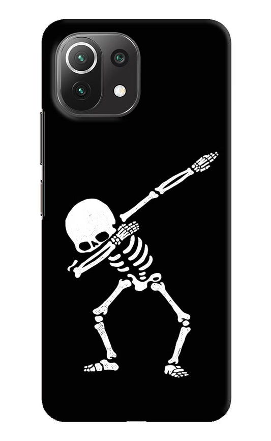 Dabbing Skeleton Art Mi 11 Lite NE 5G Hard Case Back Cover by Casekaro