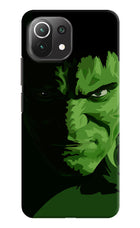 HULK Mi 11 Lite NE 5G Hard Case Back Cover by Casekaro