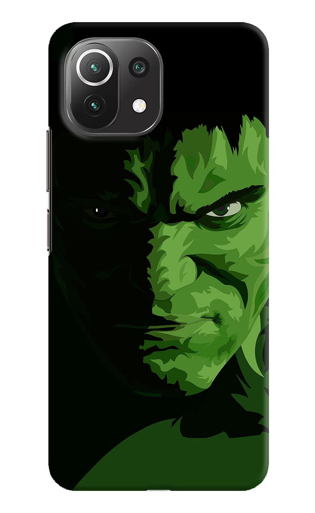 HULK Mi 11 Lite NE 5G Hard Case Back Cover by Casekaro