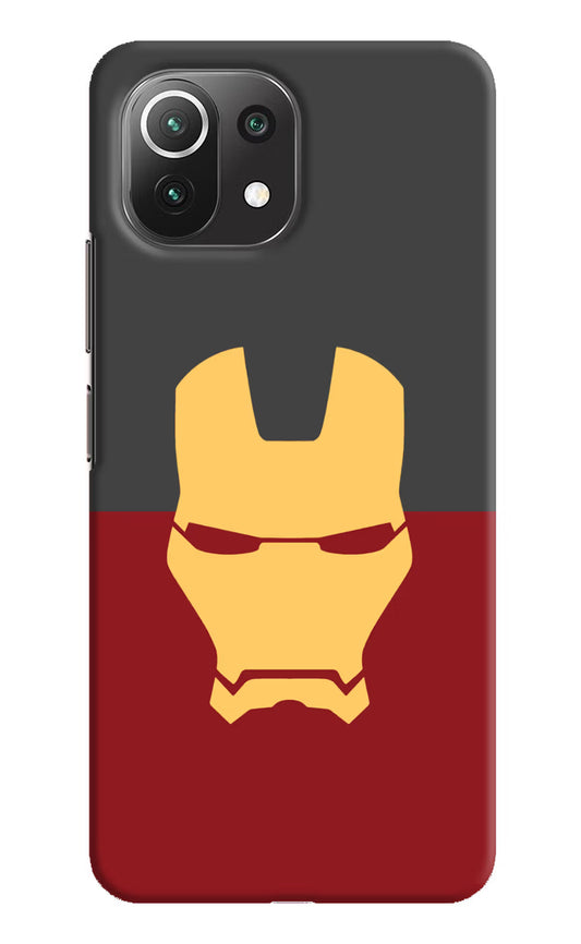 Ironman Mi 11 Lite NE 5G Hard Case Back Cover by Casekaro