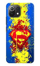 Superman logo Mi 11 Lite NE 5G Hard Case Back Cover by Casekaro