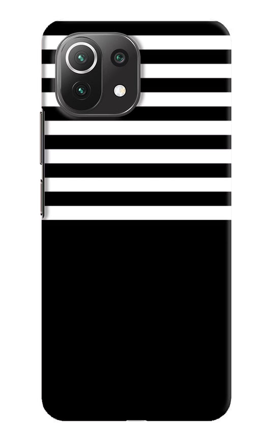 Black and White Print Mi 11 Lite NE 5G Hard Case Back Cover by Casekaro