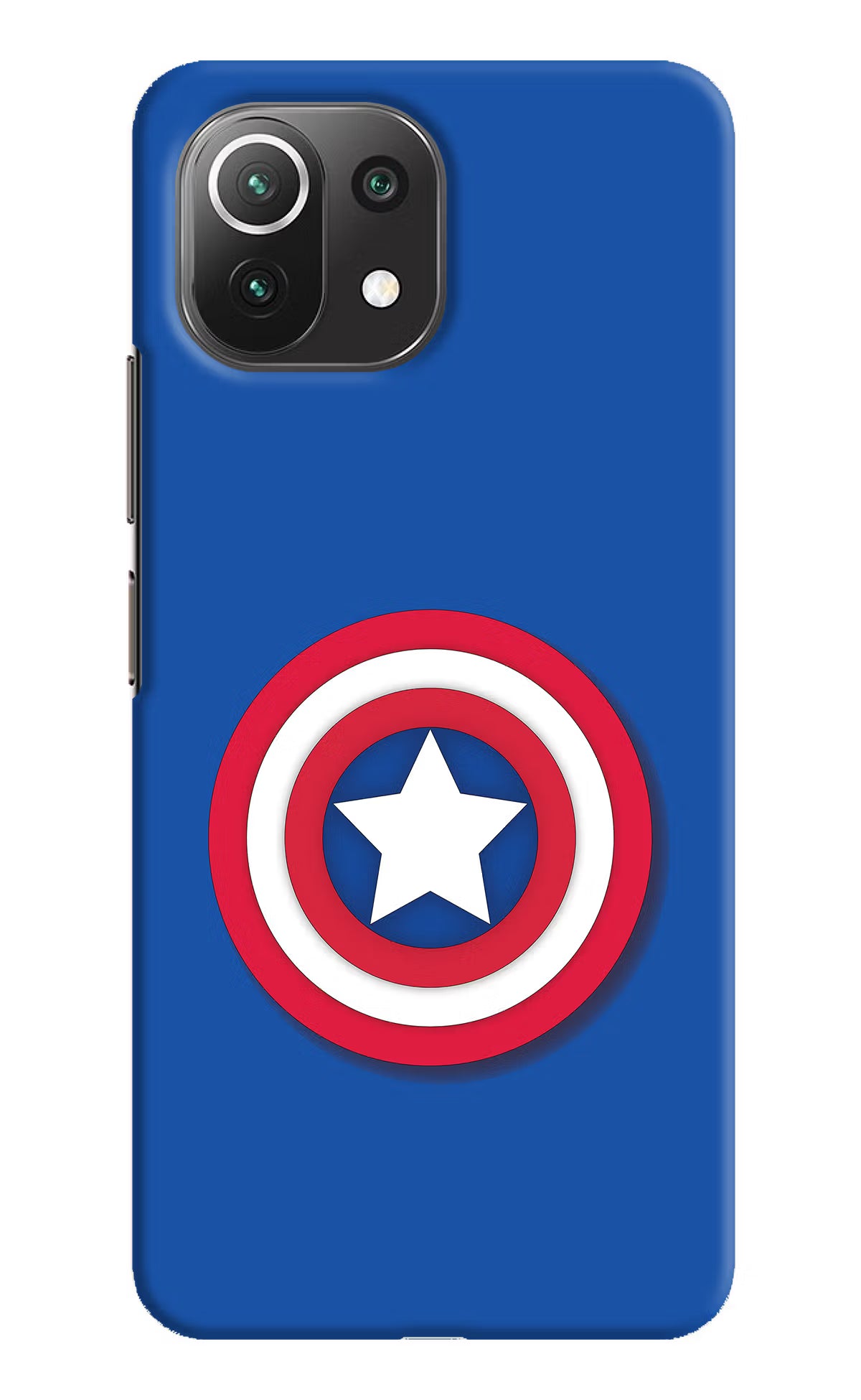 Shield Mi 11 Lite NE 5G Hard Case Back Cover by Casekaro