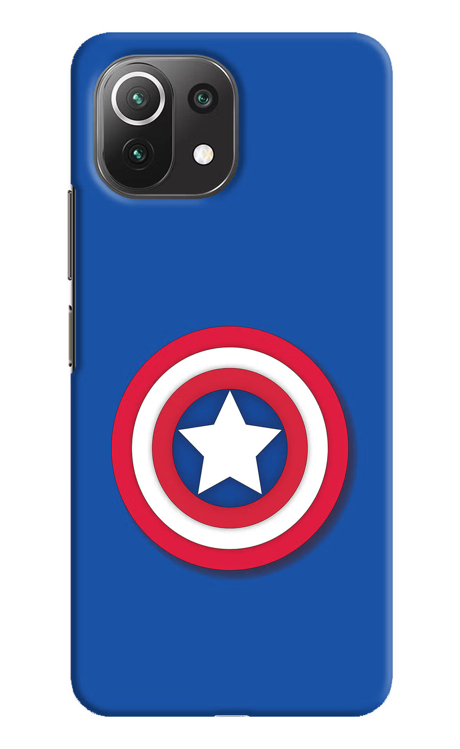 Shield Mi 11 Lite NE 5G Back Cover, Hard case