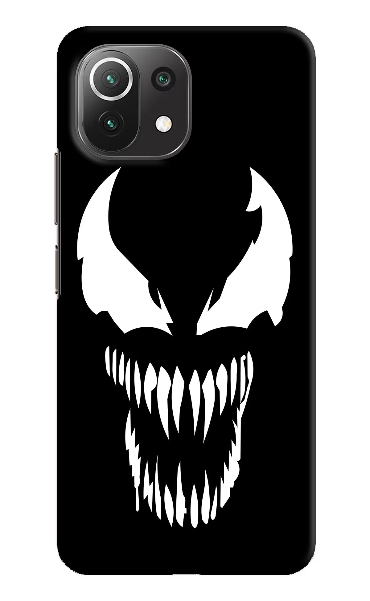 Venom Mi 11 Lite NE 5G Hard Case Back Cover by Casekaro